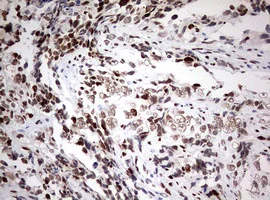 Immunohistochemistry (Formalin/PFA-fixed paraffin-embedded sections) - Anti-ZEB1 antibody [OTI3G6] - N-terminal (AB180905)
