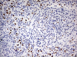 Immunohistochemistry (Formalin/PFA-fixed paraffin-embedded sections) - Anti-ZEB1 antibody [OTI3G6] - N-terminal (AB180905), expandable thumbnail