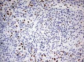 Immunohistochemistry (Formalin/PFA-fixed paraffin-embedded sections) - Anti-ZEB1 antibody [OTI3G6] - N-terminal (AB180905)