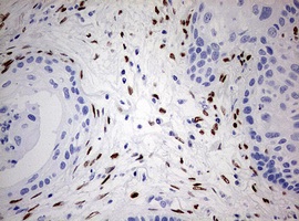 Immunohistochemistry (Formalin/PFA-fixed paraffin-embedded sections) - Anti-ZEB1 antibody [OTI3G6] - N-terminal (ab180905), expandable thumbnail