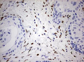Immunohistochemistry (Formalin/PFA-fixed paraffin-embedded sections) - Anti-ZEB1 antibody [OTI3G6] - N-terminal (AB180905)