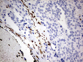 Immunohistochemistry (Formalin/PFA-fixed paraffin-embedded sections) - Anti-ZEB1 antibody [OTI3G6] - N-terminal (AB180905), expandable thumbnail