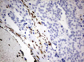 Immunohistochemistry (Formalin/PFA-fixed paraffin-embedded sections) - Anti-ZEB1 antibody [OTI3G6] - N-terminal (AB180905)