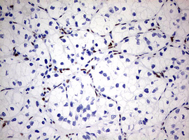 Immunohistochemistry (Formalin/PFA-fixed paraffin-embedded sections) - Anti-ZEB1 antibody [OTI3G6] - N-terminal (AB180905), expandable thumbnail