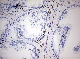 Immunohistochemistry (Formalin/PFA-fixed paraffin-embedded sections) - Anti-ZEB1 antibody [OTI3G6] - N-terminal (AB180905), expandable thumbnail