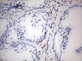Immunohistochemistry (Formalin/PFA-fixed paraffin-embedded sections) - Anti-ZEB1 antibody [OTI3G6] - N-terminal (AB180905)