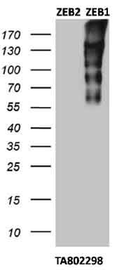 Western blot - Anti-ZEB1 antibody [OTI3G6] - N-terminal (ab180905), expandable thumbnail