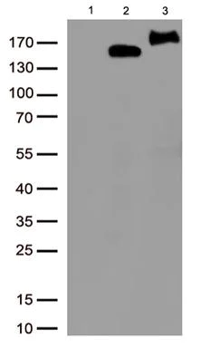 Western blot - Anti-ZEB1 antibody [OTI3G6] - N-terminal (AB180905)