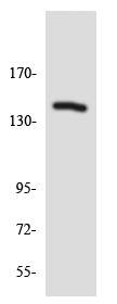 Western blot - Anti-ZEB2 antibody (AB138222)