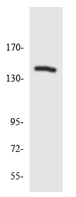 Western blot - Anti-ZEB2 antibody (AB138222)