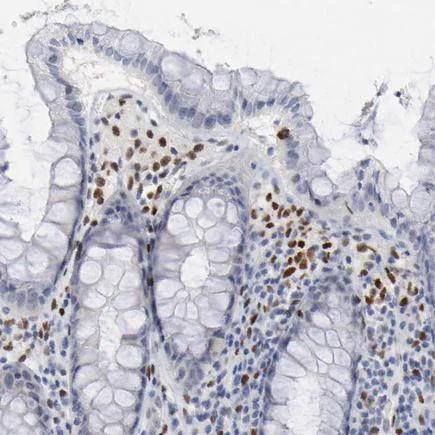 Immunohistochemistry (Formalin/PFA-fixed paraffin-embedded sections) - Anti-ZEB2 antibody (AB223688)