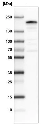 Western blot - Anti-ZEB2 antibody (AB223688)