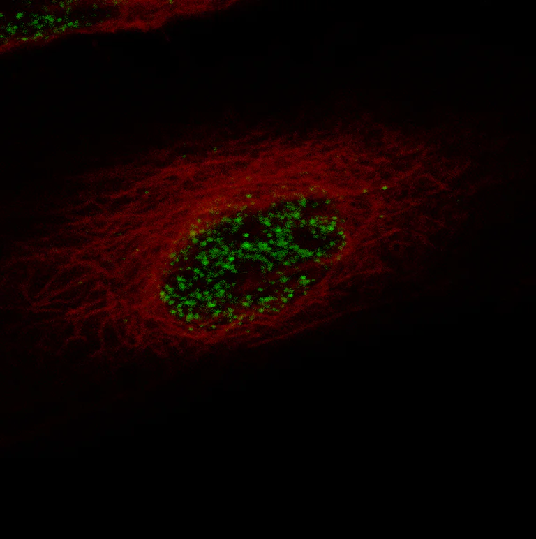 Immunocytochemistry/ Immunofluorescence - Anti-ZEB2 Antibody [CL13467] (AB327146)