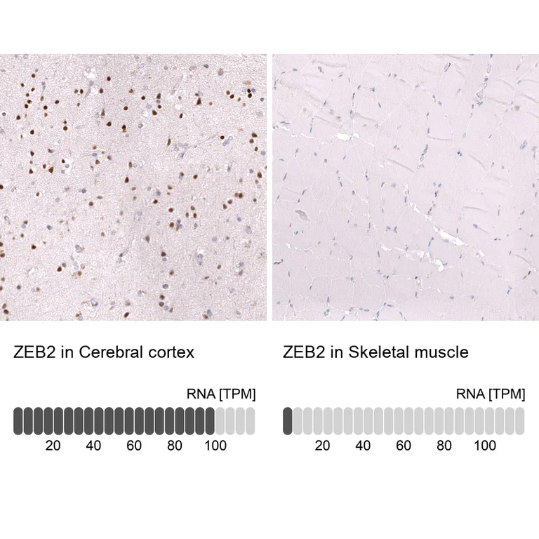 Immunohistochemistry (Formalin/PFA-fixed paraffin-embedded sections) - Anti-ZEB2 Antibody [CL13467] (AB327146)