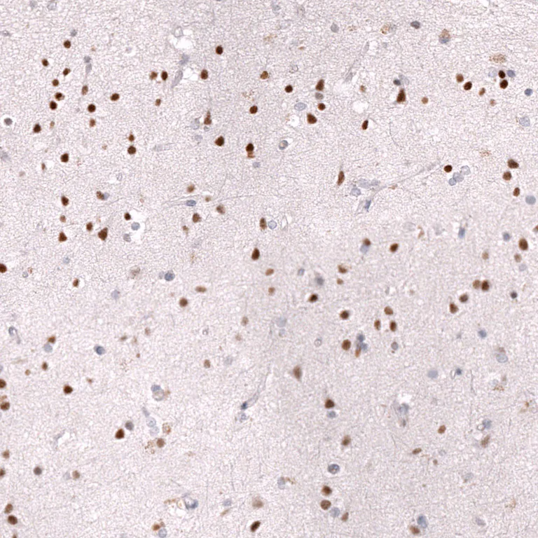 Immunohistochemistry (Formalin/PFA-fixed paraffin-embedded sections) - Anti-ZEB2 Antibody [CL13467] (AB327146)