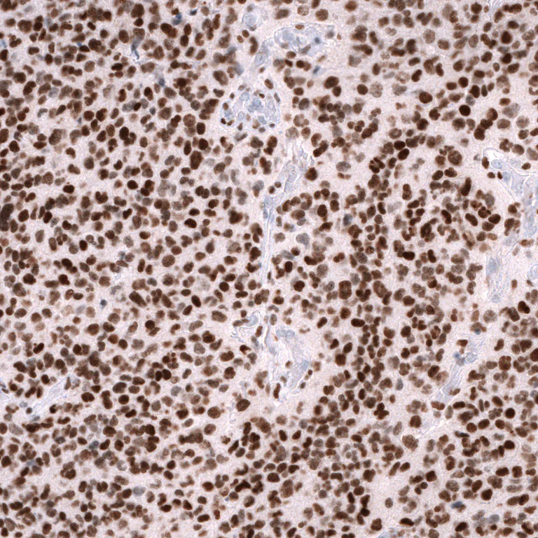 Immunohistochemistry (Formalin/PFA-fixed paraffin-embedded sections) - Anti-ZEB2 Antibody [CL13467] (AB327146)