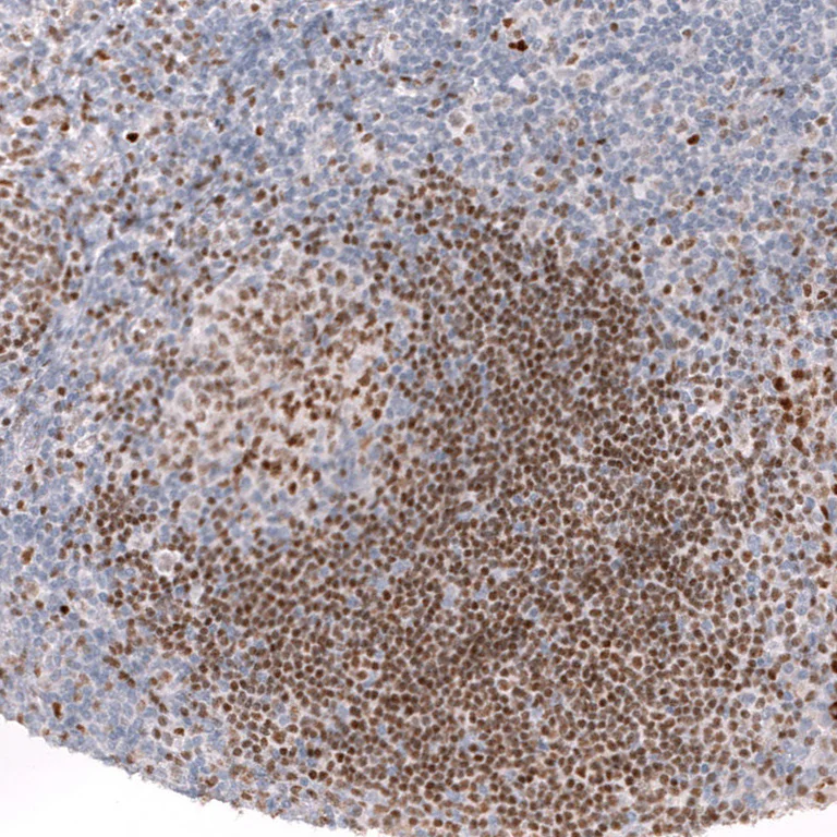 Immunohistochemistry (Formalin/PFA-fixed paraffin-embedded sections) - Anti-ZEB2 Antibody [CL13467] (AB327146)
