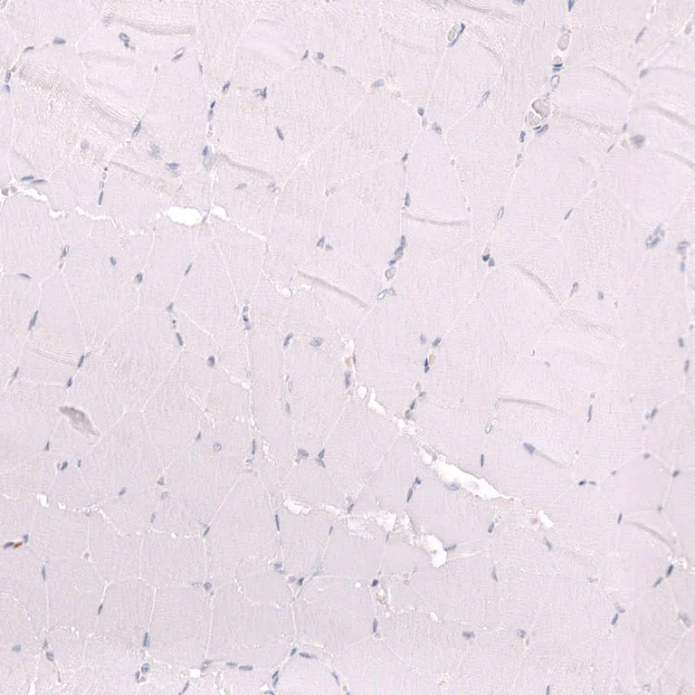 Immunohistochemistry (Formalin/PFA-fixed paraffin-embedded sections) - Anti-ZEB2 Antibody [CL13467] (AB327146)