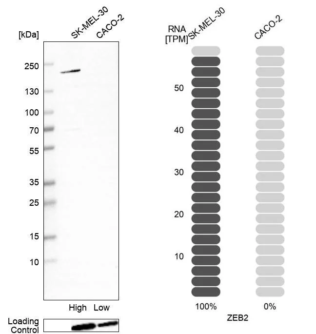 Western blot - Anti-ZEB2 Antibody [CL13467] (AB327146)