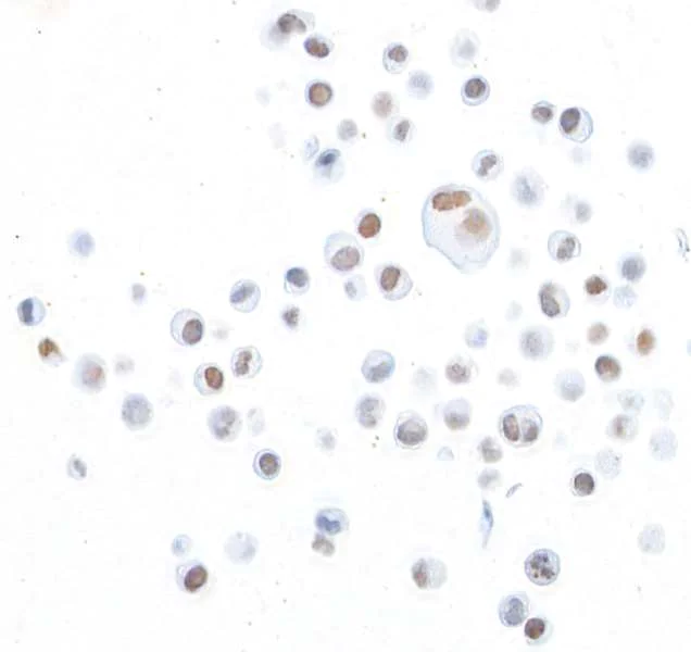 Immunocytochemistry - Anti-ZEB2/SIP antibody [BLR115H] - BSA free (AB314074)