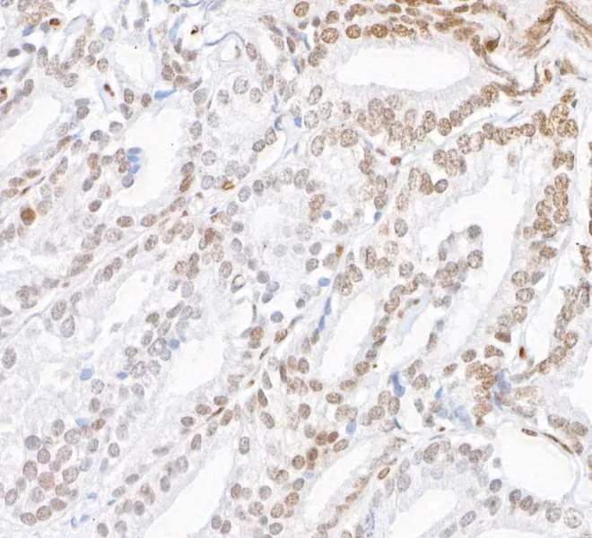 Immunohistochemistry (Formalin/PFA-fixed paraffin-embedded sections) - Anti-ZEB2/SIP antibody [BLR115H] - BSA free (AB314074)