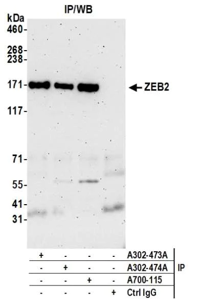 Immunoprecipitation - Anti-ZEB2/SIP antibody [BLR115H] - BSA free (AB314074)