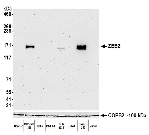 Western blot - Anti-ZEB2/SIP antibody [BLR115H] - BSA free (AB314074)