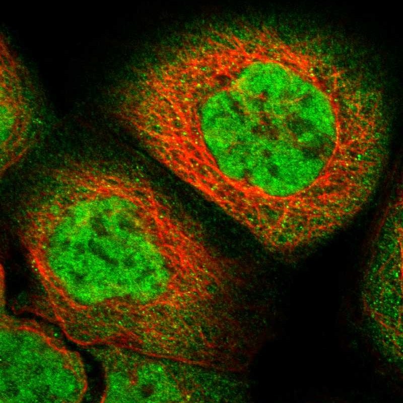 Immunocytochemistry/ Immunofluorescence - Anti-ZFAND5 antibody (AB272580), expandable thumbnail