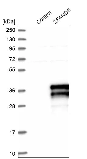 Western blot - Anti-ZFAND5 antibody (AB272580)