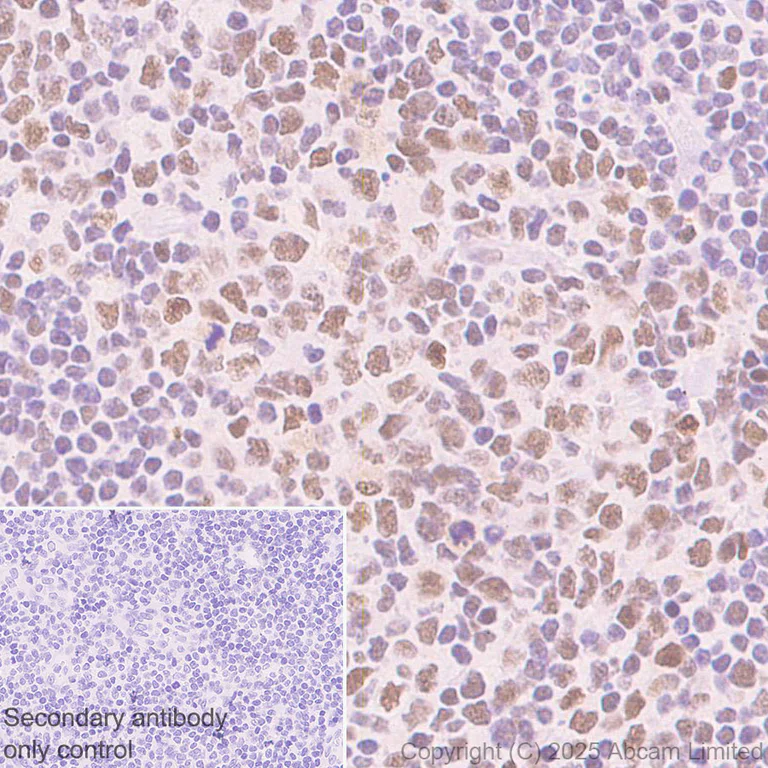 Immunohistochemistry (Formalin/PFA-fixed paraffin-embedded sections) - Anti-Zfp281/ZNF281 antibody [EPR30593-518] (AB325790)
