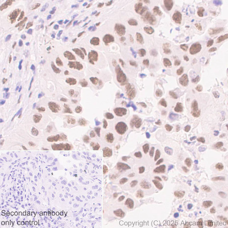 Immunohistochemistry (Formalin/PFA-fixed paraffin-embedded sections) - Anti-Zfp281/ZNF281 antibody [EPR30593-518] (AB325790)