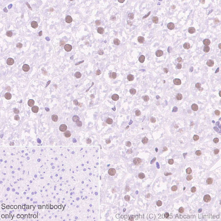 Immunohistochemistry (Formalin/PFA-fixed paraffin-embedded sections) - Anti-Zfp281/ZNF281 antibody [EPR30593-518] (AB325790)