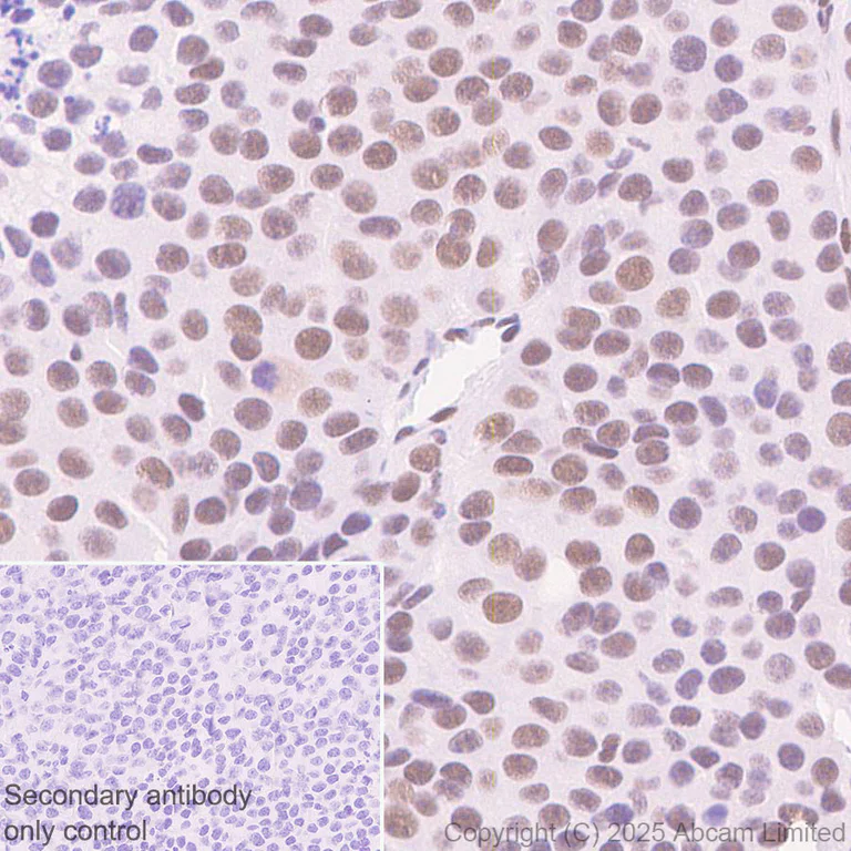 Immunohistochemistry (Formalin/PFA-fixed paraffin-embedded sections) - Anti-Zfp281/ZNF281 antibody [EPR30593-518] (AB325790)