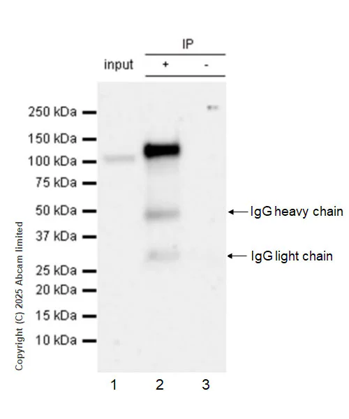 Immunoprecipitation - Anti-Zfp281/ZNF281 antibody [EPR30593-518] (AB325790)