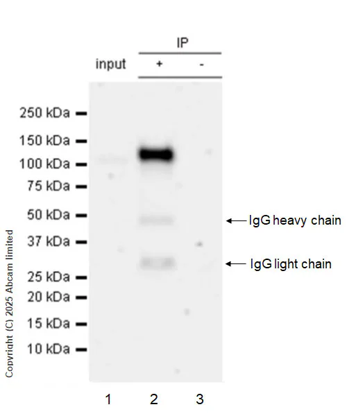 Immunoprecipitation - Anti-Zfp281/ZNF281 antibody [EPR30593-518] (AB325790)