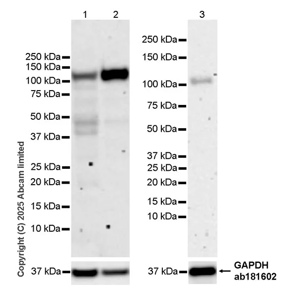 Western blot - Anti-Zfp281/ZNF281 antibody [EPR30593-518] (AB325790)