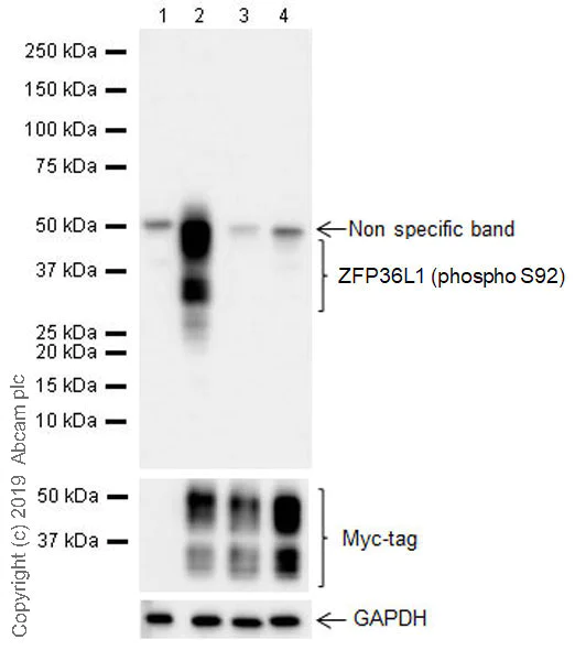 Western blot - Anti-ZFP36L1 (phospho S92) antibody [EPR19926] (AB204922)