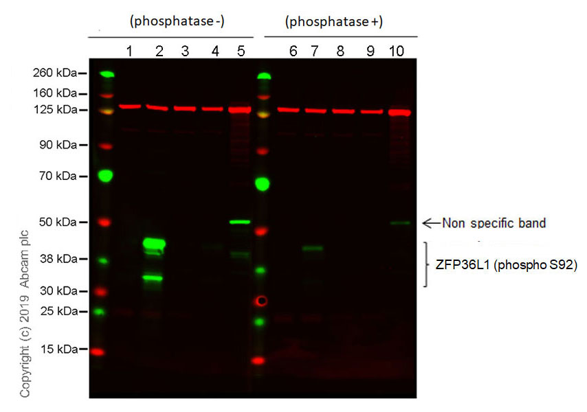 Western blot - Anti-ZFP36L1 (phospho S92) antibody [EPR19926] - BSA and Azide free (AB238459)