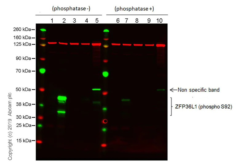 Western blot - Anti-ZFP36L1 (phospho S92) antibody [EPR19926] - BSA and Azide free (AB238459)