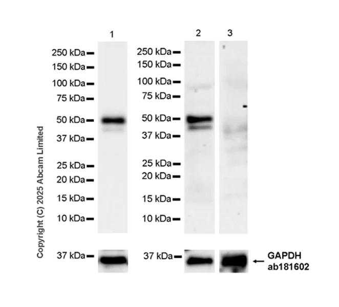 Western blot - Anti-Zfp57 antibody [EPR28485-527] (AB324145)