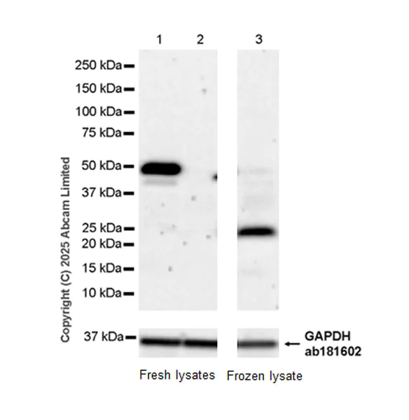 Western blot - Anti-Zfp57 antibody [EPR28485-527] - BSA and Azide free (AB324146)