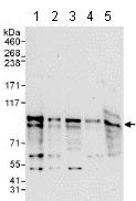 Western blot - Anti-ZFP64 antibody (AB117787)