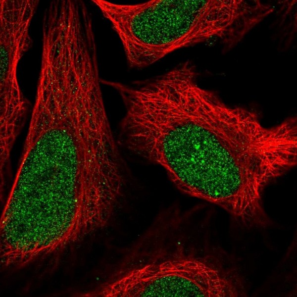 Immunocytochemistry/ Immunofluorescence - Anti-ZFP64 antibody (AB204610), expandable thumbnail