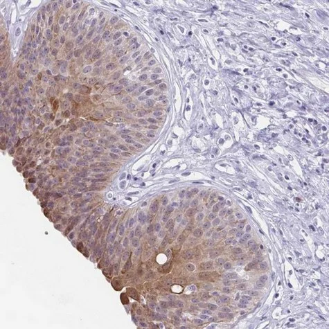 Immunohistochemistry (Formalin/PFA-fixed paraffin-embedded sections) - Anti-ZFP64 antibody (AB204610)