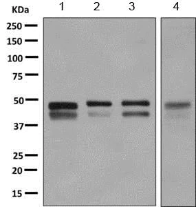 Western blot - Anti-ZFYVE19 antibody [EPR9789] - BSA and Azide free (AB249180)