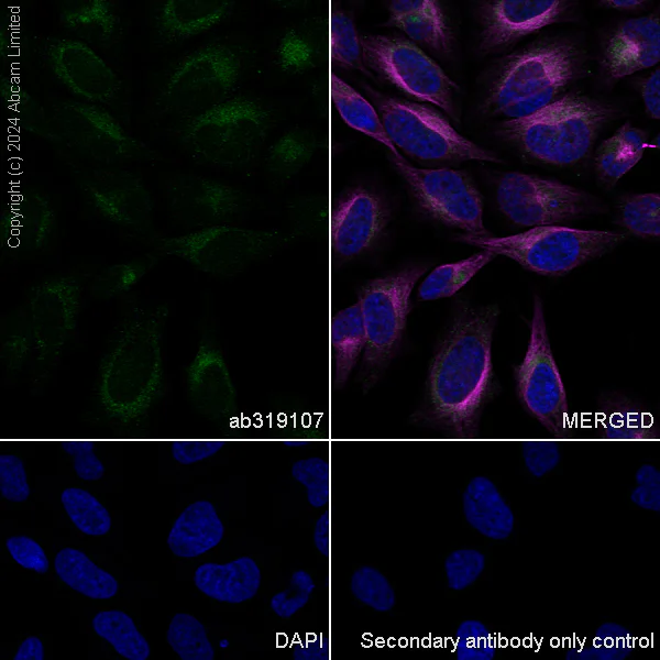 Immunocytochemistry/ Immunofluorescence - Anti-ZFYVE26 antibody [EPR28782-38] - BSA and Azide free (AB319108)