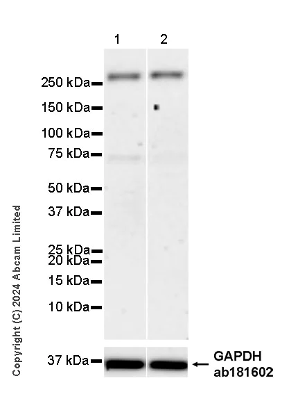 Western blot - Anti-ZFYVE26 antibody [EPR28782-38] - BSA and Azide free (AB319108)
