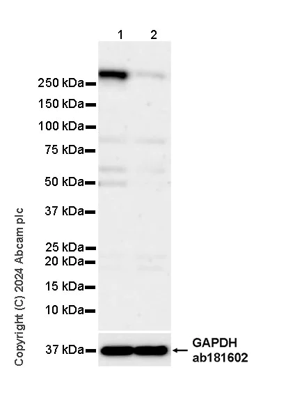 Western blot - Anti-ZFYVE26 antibody [EPR28782-59] - BSA and Azide free (AB319052)