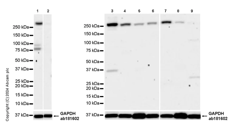 Western blot - Anti-ZFYVE26 antibody [EPR28782-59] - BSA and Azide free (AB319052)