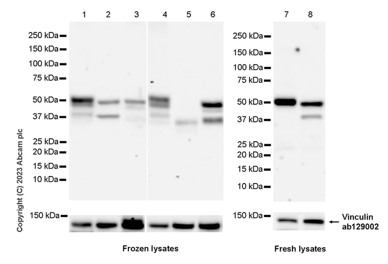 Western blot - Anti-ZFYVE27 antibody [EPR28129-93] (AB314323)